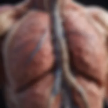 Lung Anatomy and Cancerous Regions Detailed illustration of lung anatomy highlighting cancerous regions