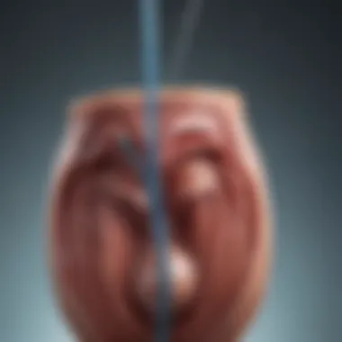 Types of Bladder Sling Procedures Illustration depicting various types of bladder sling procedures