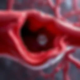 Illustration of coronary artery with calcification deposits