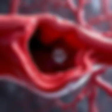 Coronary Artery Calcification Depiction Illustration of coronary artery with calcification deposits