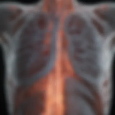 CT scan illustrating the severity of emphysema in a patient's lungs