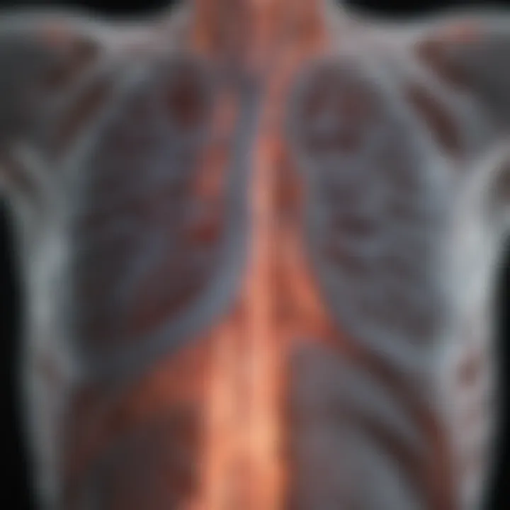 CT scan illustrating the severity of emphysema in a patient's lungs