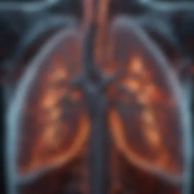 Lung Airspace Enlargement in Emphysema Radiological view of emphysematous changes highlighting lung airspace enlargement