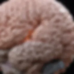 Brain scan highlighting areas of mild cerebral atrophy