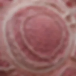 Histological slide showcasing mucinous features in invasive ductal carcinoma