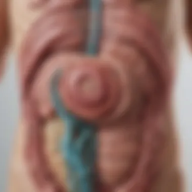 Illustration of the gastrointestinal tract affected by gastroparesis