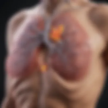 Lung Cancer Staging: Impact on Pleural Effusion Graphical representation of lung cancer staging and its influence on pleural effusion.