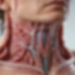 Illustration depicting the respiratory system affected by bronchiectasis