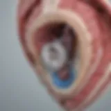 Diagram illustrating the anatomy of the tricuspid valve