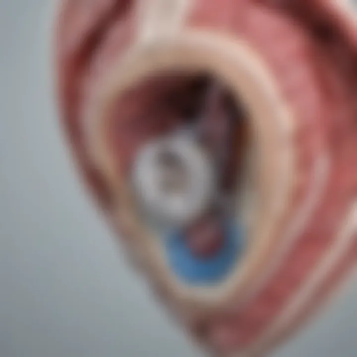 Diagram illustrating the anatomy of the tricuspid valve