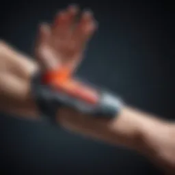 Illustration of shock wave therapy application on the wrist.
