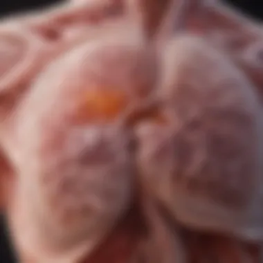 Visual Representation of Pleural Plaques Illustration of pleural plaques on lung tissue