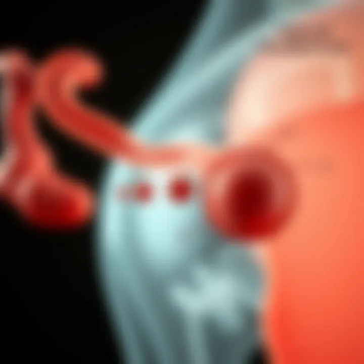 Types of Ovarian Cysts Diagram illustrating different types of ovarian cysts