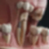 Anatomical diagram illustrating tooth structure and reimplantation site