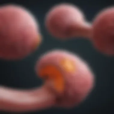 Stages of Prostate Cancer Development Diagram illustrating the stages of prostate cancer