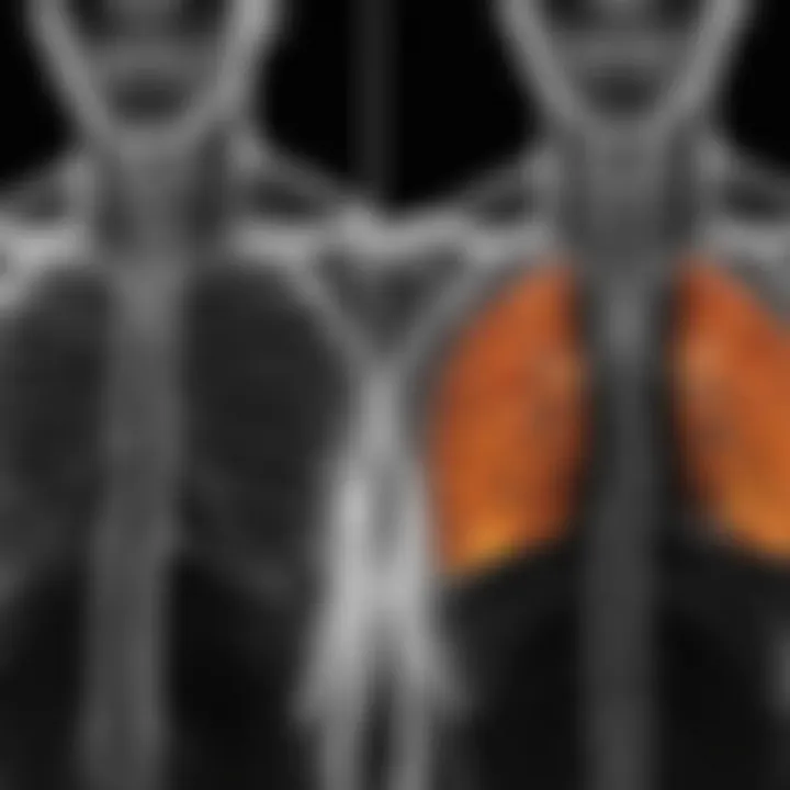 Comparison of X-ray and CT imaging in respiratory conditions