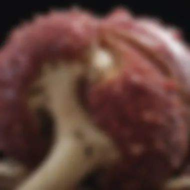 Bone Lesions in Multiple Myeloma Visual representation of Bone lesions associated with multiple myeloma