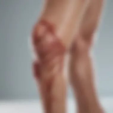 Exploring Leg Ulcer Treatment Options A close-up of a leg ulcer showing potential treatment options.