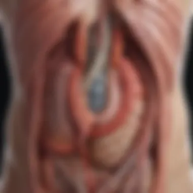 Illustration depicting the anatomy of the stomach and duodenum affected by peptic ulcers.