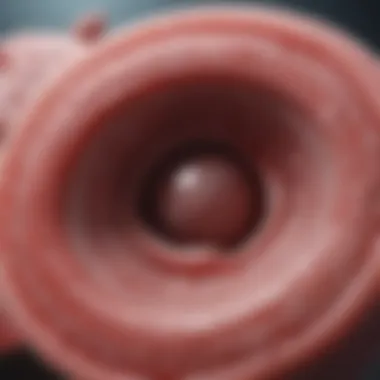 Diagram explaining the physiological mechanisms of ulcer formation.