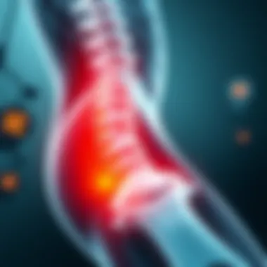 Understanding Sciatica: Inflammation and Its Implications Summary Understanding Sciatica: Inflammation and Its Implications Summary