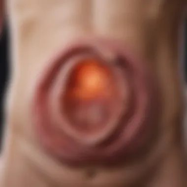 An illustration of a stomach showing ulcer locations