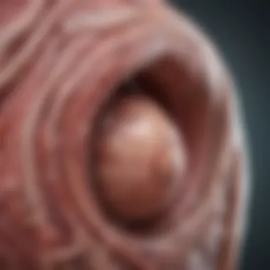 Anatomical Overview of Testicular Hernia Anatomical illustration of a testicular hernia highlighting the affected area