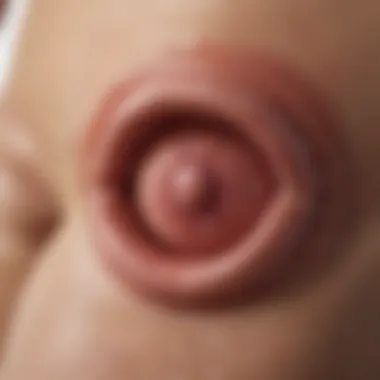Symptoms of Vulvar Ulcers Diagram showing symptoms associated with vulvar ulcers