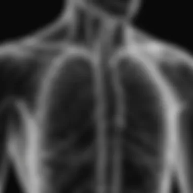 X-ray showing characteristic features of emphysema